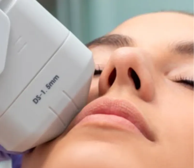 Ultherapy Singapore – Non-Surgical Skin Lifting at Shine Dermatology