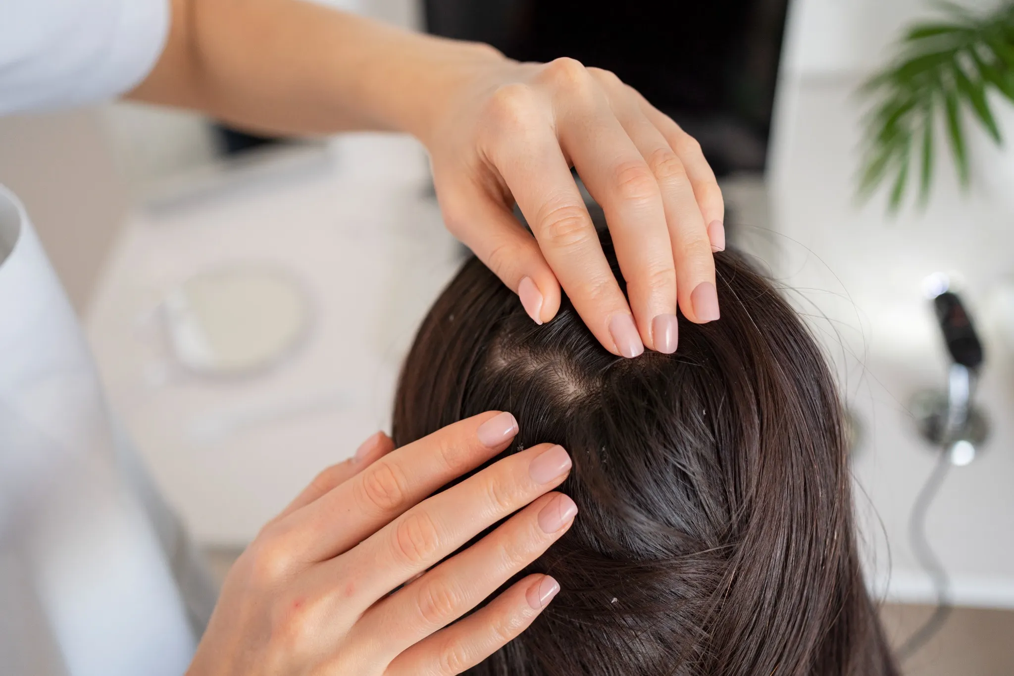 Close up of scalp, get healthy scalp with the help of your dermatologist