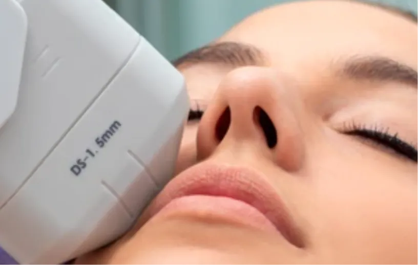 Ultherapy Skin Tightening<